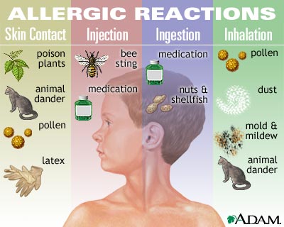 Photo taken from http://home.allergicchild.com/allergies/