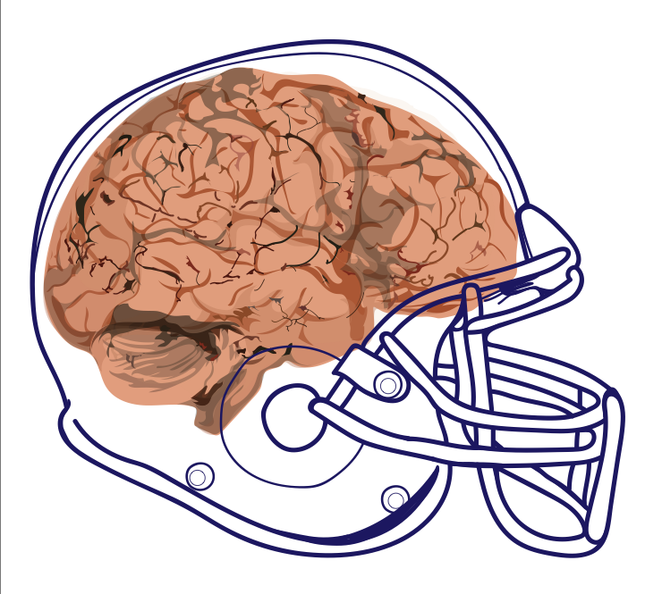 There are many risks in playing football while concussed. Graphic by Riley Lynch 18.